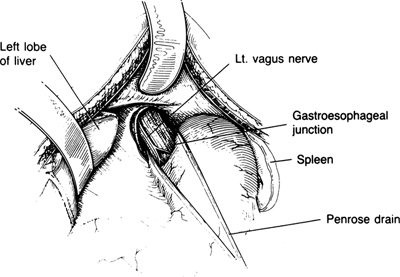 A978-0-387-09515-8_5_Fig18_HTML.jpg