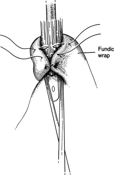 A978-0-387-09515-8_5_Fig20_HTML.jpg