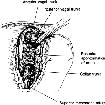 A978-0-387-09515-8_5_Fig25_HTML.jpg