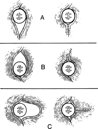 A978-0-387-09515-8_5_Fig7_HTML.jpg