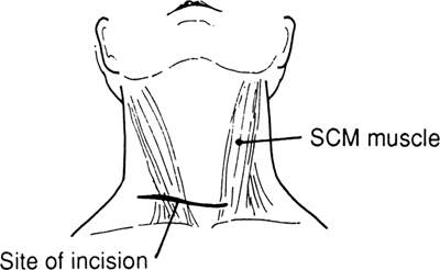 A978-0-387-09515-8_6_Fig10_HTML.jpg