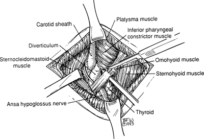 A978-0-387-09515-8_6_Fig11_HTML.jpg