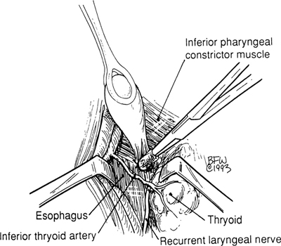 A978-0-387-09515-8_6_Fig12_HTML.jpg