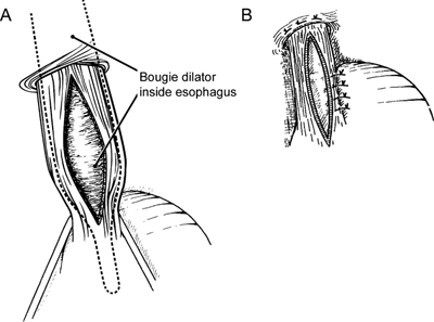 A978-0-387-09515-8_6_Fig18_HTML.jpg