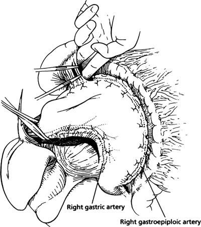 A978-0-387-09515-8_6_Fig24_HTML.jpg