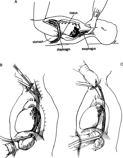 A978-0-387-09515-8_6_Fig28_HTML.jpg