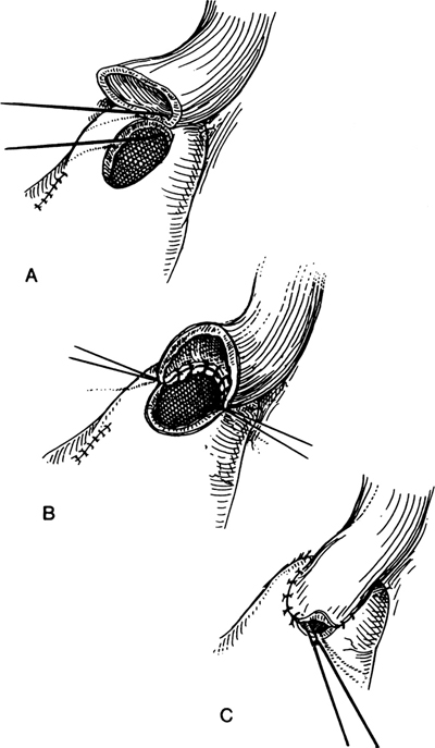 A978-0-387-09515-8_6_Fig32_HTML.jpg