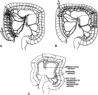 A978-0-387-09515-8_6_Fig37_HTML.jpg