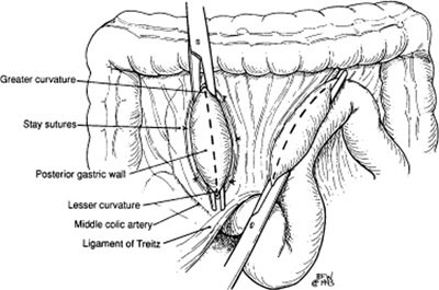 A978-0-387-09515-8_7_Fig12_HTML.jpg