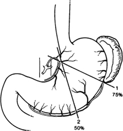 A978-0-387-09515-8_7_Fig22_HTML.jpg