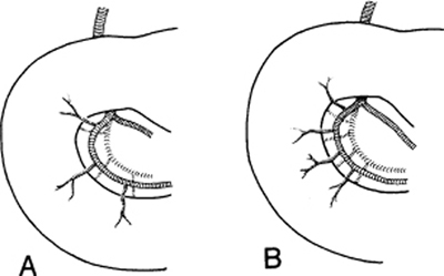 A978-0-387-09515-8_7_Fig25_HTML.jpg