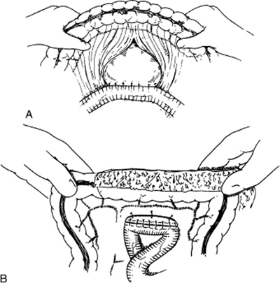 A978-0-387-09515-8_7_Fig43_HTML.jpg