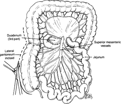 A978-0-387-09515-8_8_Fig9_HTML.jpg