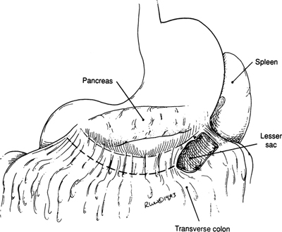 A978-0-387-09515-8_9_Fig12_HTML.jpg