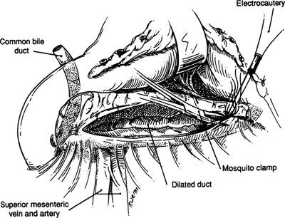 A978-0-387-09515-8_9_Fig13_HTML.jpg