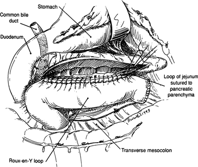 A978-0-387-09515-8_9_Fig16_HTML.jpg