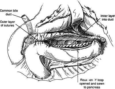 A978-0-387-09515-8_9_Fig17_HTML.jpg