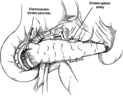 A978-0-387-09515-8_9_Fig22_HTML.jpg