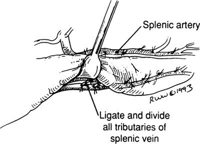 A978-0-387-09515-8_9_Fig25_HTML.jpg