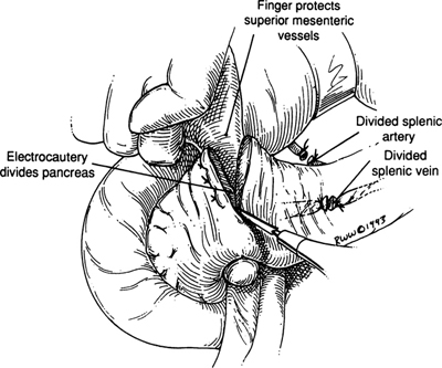 A978-0-387-09515-8_9_Fig27_HTML.jpg