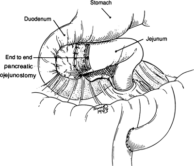 A978-0-387-09515-8_9_Fig28_HTML.jpg