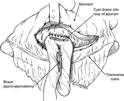 A978-0-387-09515-8_9_Fig46_HTML.jpg