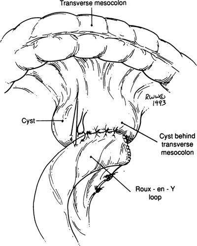 A978-0-387-09515-8_9_Fig47_HTML.jpg