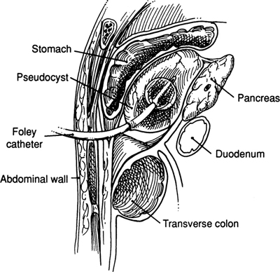 A978-0-387-09515-8_9_Fig48_HTML.jpg