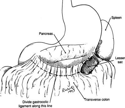 A978-0-387-09515-8_9_Fig49_HTML.jpg