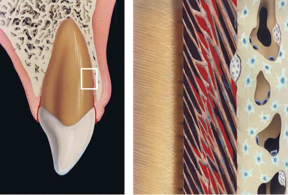 2 Illustrations displaying nature of trauma in the case of crushing injury.