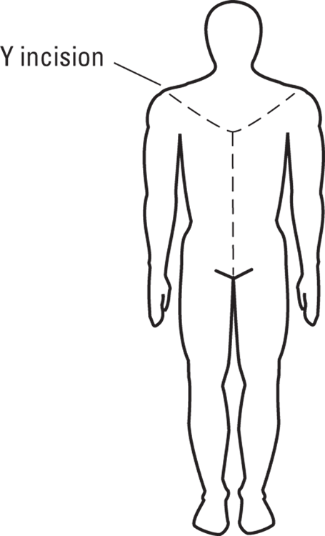 Sketch depicting Y-shaped incision used during most autopsies on a human body.