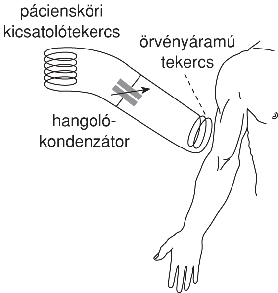 IX.2. táblázat. A nagyfrekvenciás hôterápiában szokásos eljárások