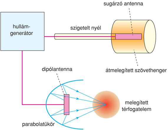 IX/5.3. Elektromos sebészet