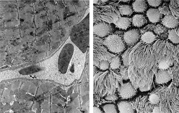 X/5.3.2. Pásztázó (scanning) elektronmikroszkópia: SEM