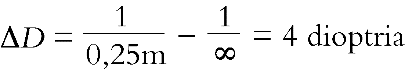 IV/2.2.1. Optikai leképezés a szemben