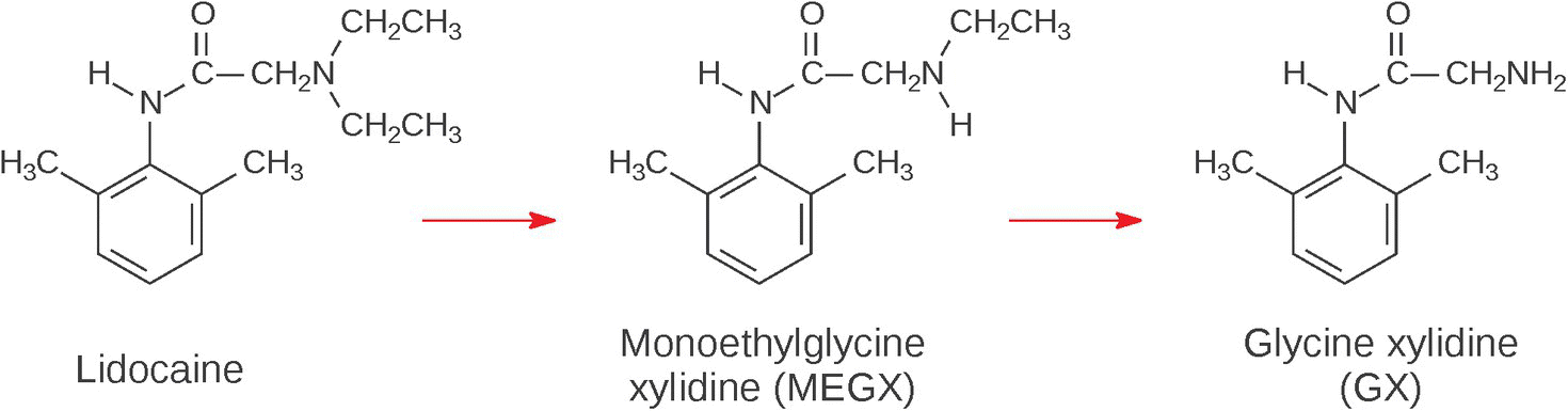 Schematic flow illustrating desethylation of lidocaine to the less active monoethyl metabolite (MEGX) and to the inactive desdiethylmetabolite (GX).