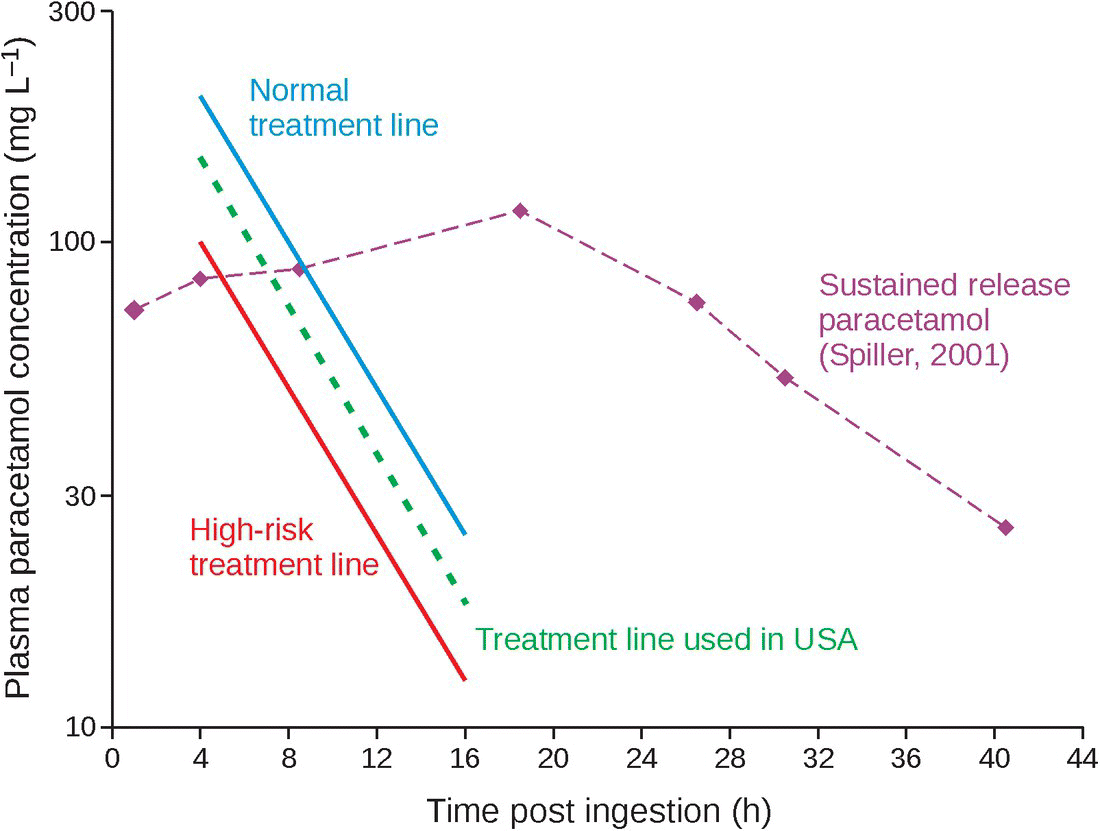 Graph of plasma paracetamol concentration (mg L-1) over time post ingestion, with 3 slopes and a curve labeled normal and high risk treatment lines, treatment line used in USA, and sustained release paracetamol.  