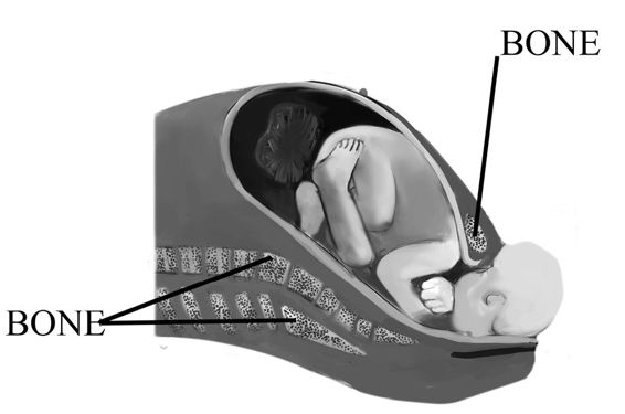 fig%2011-1--baby%20crowning.jpg