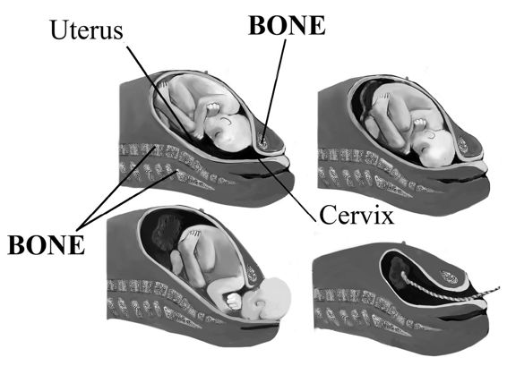 fig%2011-2--birth%20process.jpg