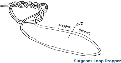 Surgeons Loop Dropper