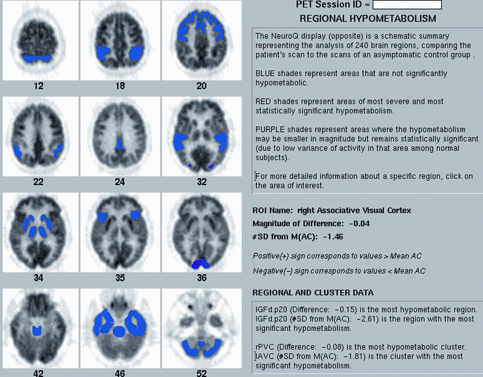 A978-0-387-76420-7_7_Fig17b_HTML.gif