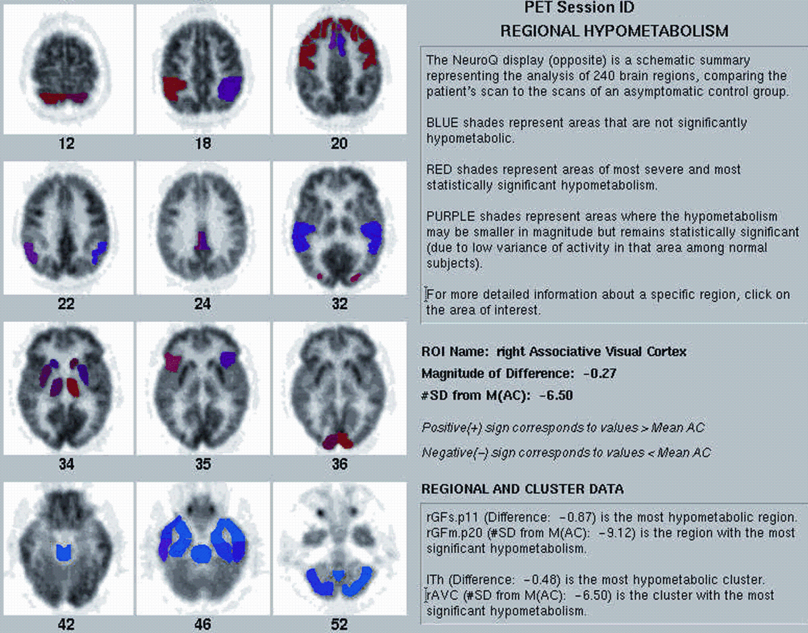 A978-0-387-76420-7_7_Fig20b_HTML.gif