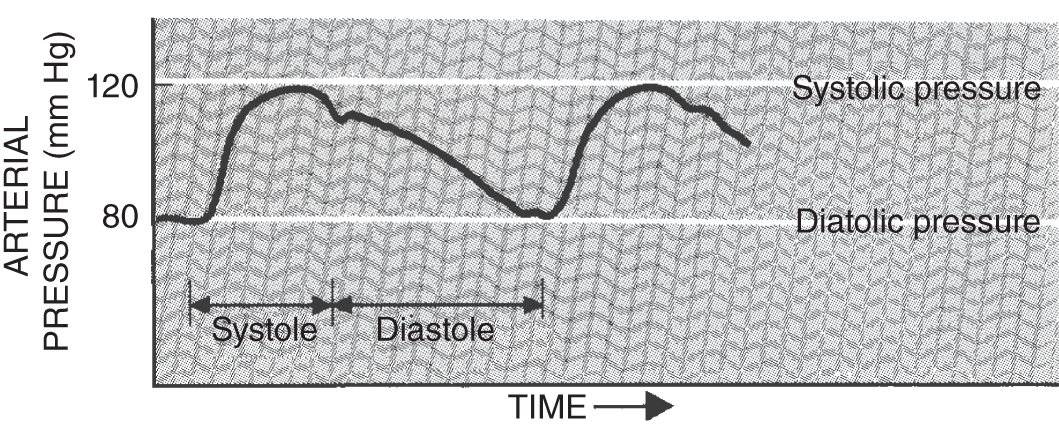 An EKG (electrocardiogram) tracing a heartbeat, measuring the arterial systolic and diastolic pressure.