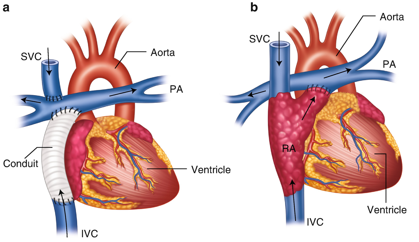 ../images/461877_1_En_14_Chapter/461877_1_En_14_Fig4_HTML.png