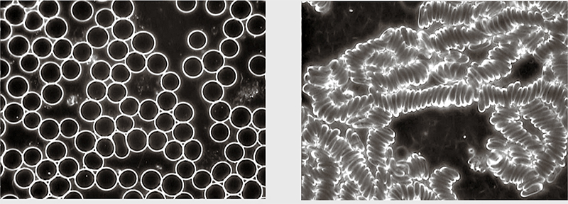 Ingrandimento di globuli rossi sani e di globuli rossi alterati e aggregati in rouleaux (Beverly Rubik, Human short-term exposure to cell phone radiation causes changes in blood cell morphology, conference paper, gennaio 2015).