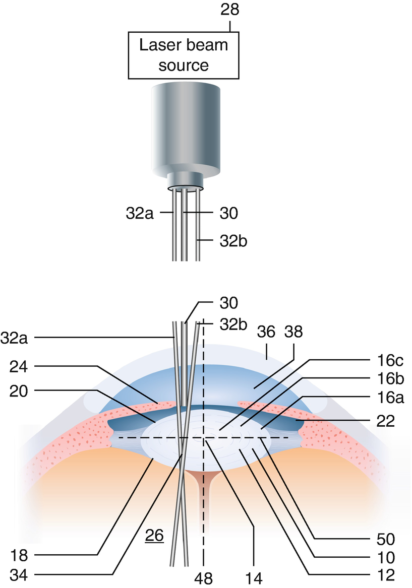 ../images/466648_1_En_14_Chapter/466648_1_En_14_Fig1_HTML.png