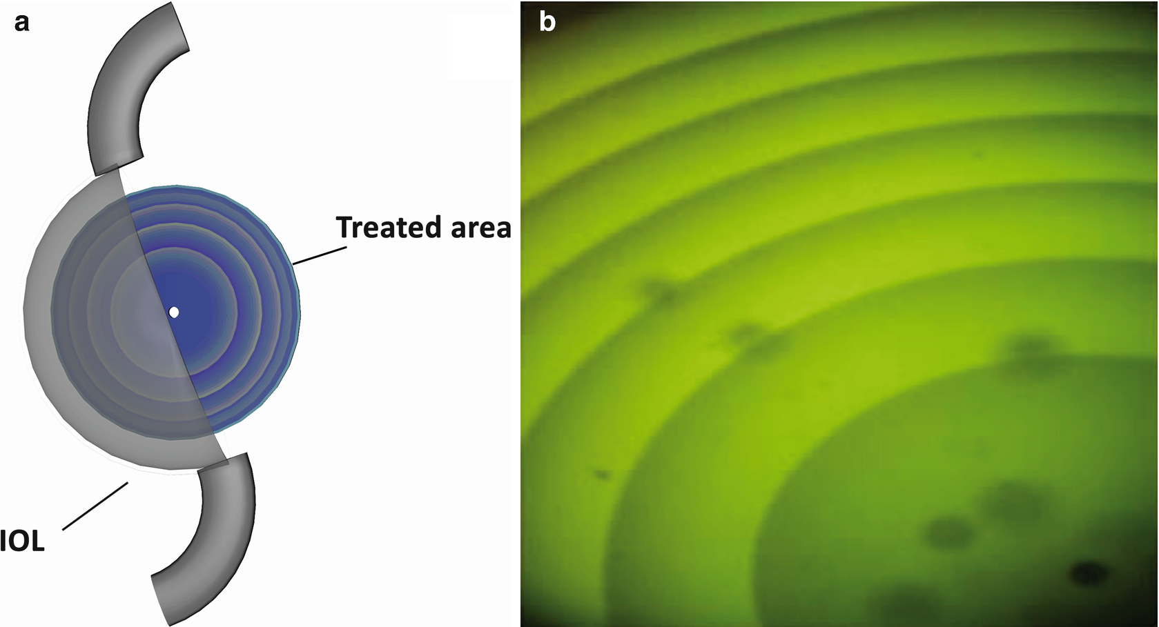 ../images/466648_1_En_15_Chapter/466648_1_En_15_Fig3_HTML.png