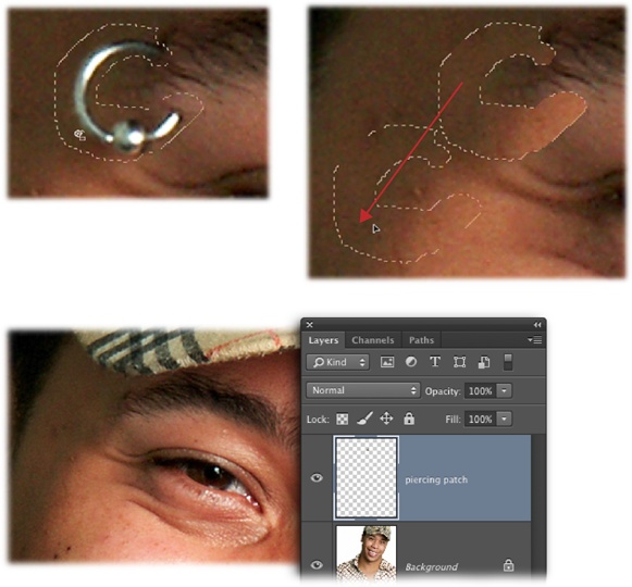 If you need to get rid of a new piercing before the parents see it, the Patch tool can get that done fast.Top: First, draw an outline of the offending area freehand (left). Once you see marching ants, click inside the selection and drag it to a good patch of skin and then release your mouse button (right).Bottom: Problem solved! The Patch tool can help you keep that piercing secret for a little while longer. And by doing the patching on an empty layer, the original image remains intact.