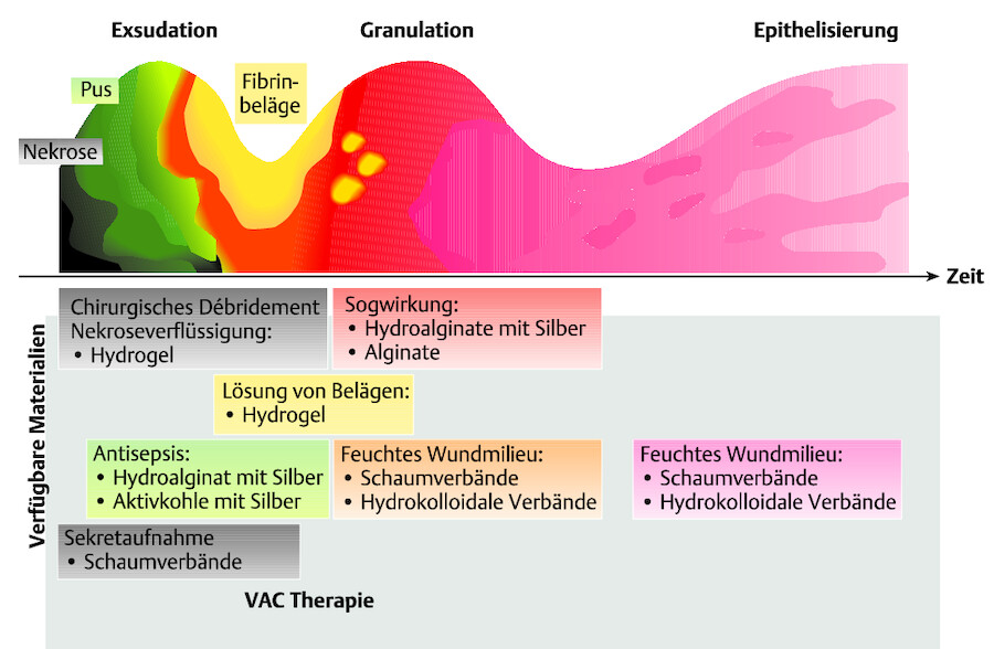 Phasengerechte Wundversorgung chronischer Wunden.