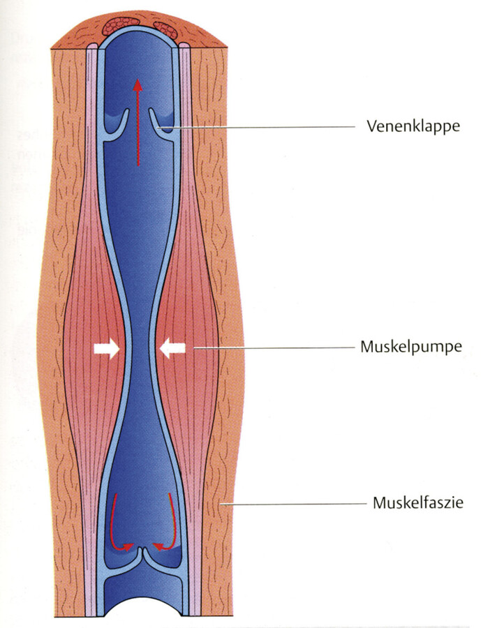 Frühmobilisierung. Die aktive Bewegung der Wadenmuskeln ist eine effektive Maßnahme zur Thromboseprophylaxe.